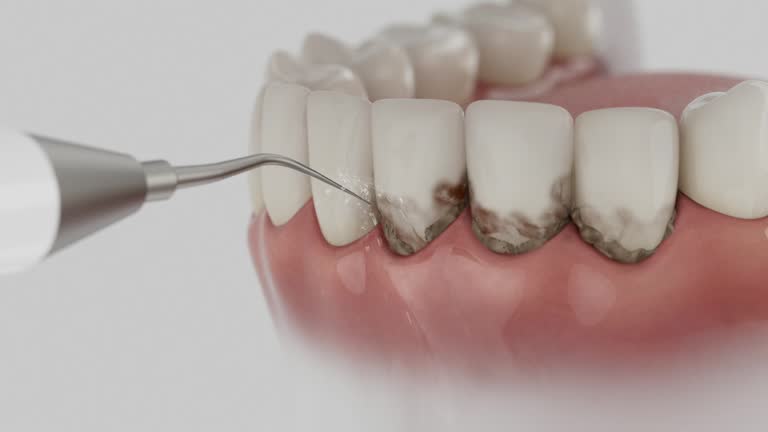 Trusted Dental Crowns And Bridges service in Shippensburg, PA - Dentist Open Now